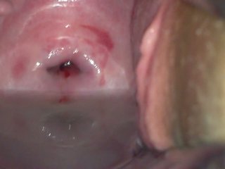 Cervix: Pussy & Amateur HD Porn Video f6