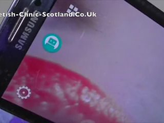 Endoscope 입 순회 공연